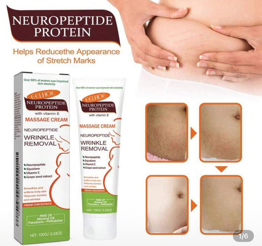 Stretch marks cream